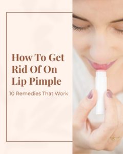 How To Get Rid of On Lip Pimple:10 Home Remedies That Work
