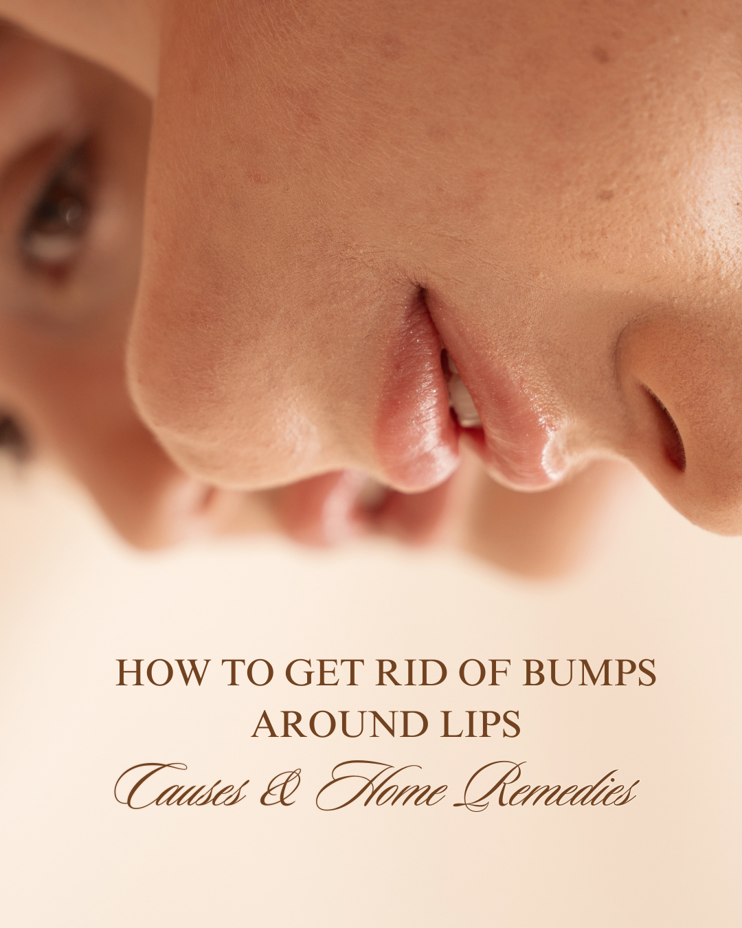 How to Get Rid of Bumps Around Lips: Causes & Home Remedies