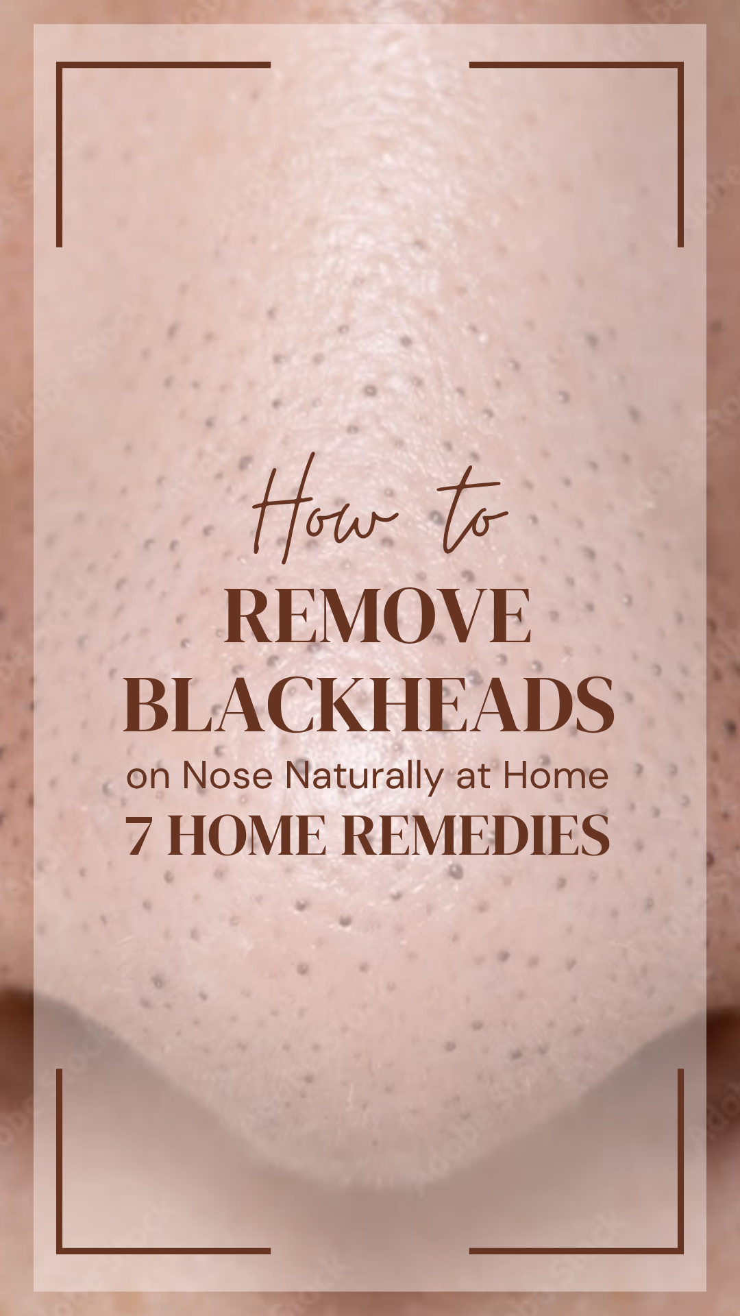 How to Remove Blackheads on Nose Naturally at Home: 7 Home Remedies